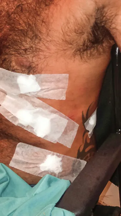 Homem ficou ferido no peito, tórax e na cabeça. 